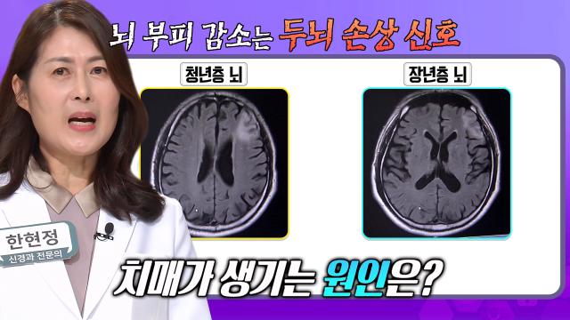 혈관 건강 이미지 3