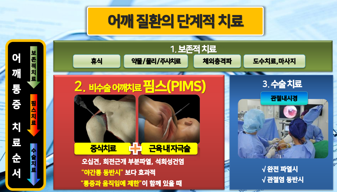  어깨통증 원인을 알면 치료법은 간단합니다