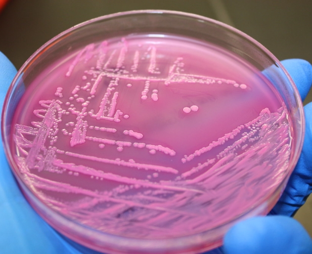 대장균 검사에 이상적인 배지2
