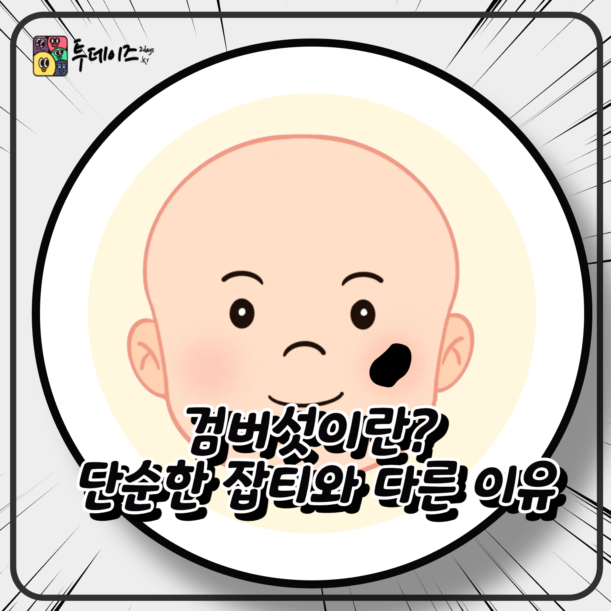 검버섯 병원 치료 홈치료 예방법 모두 함께 알아봐요! 검버섯 병원 치료 홈치료 예방법 모두 함께 알아봐요!