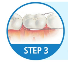 치실 사용 3번째 단계