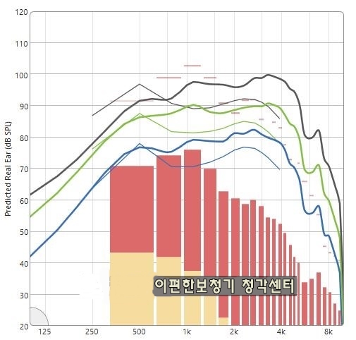  [보청기평가] 실이측정 과 스피치맵핑 이란 무엇인가?