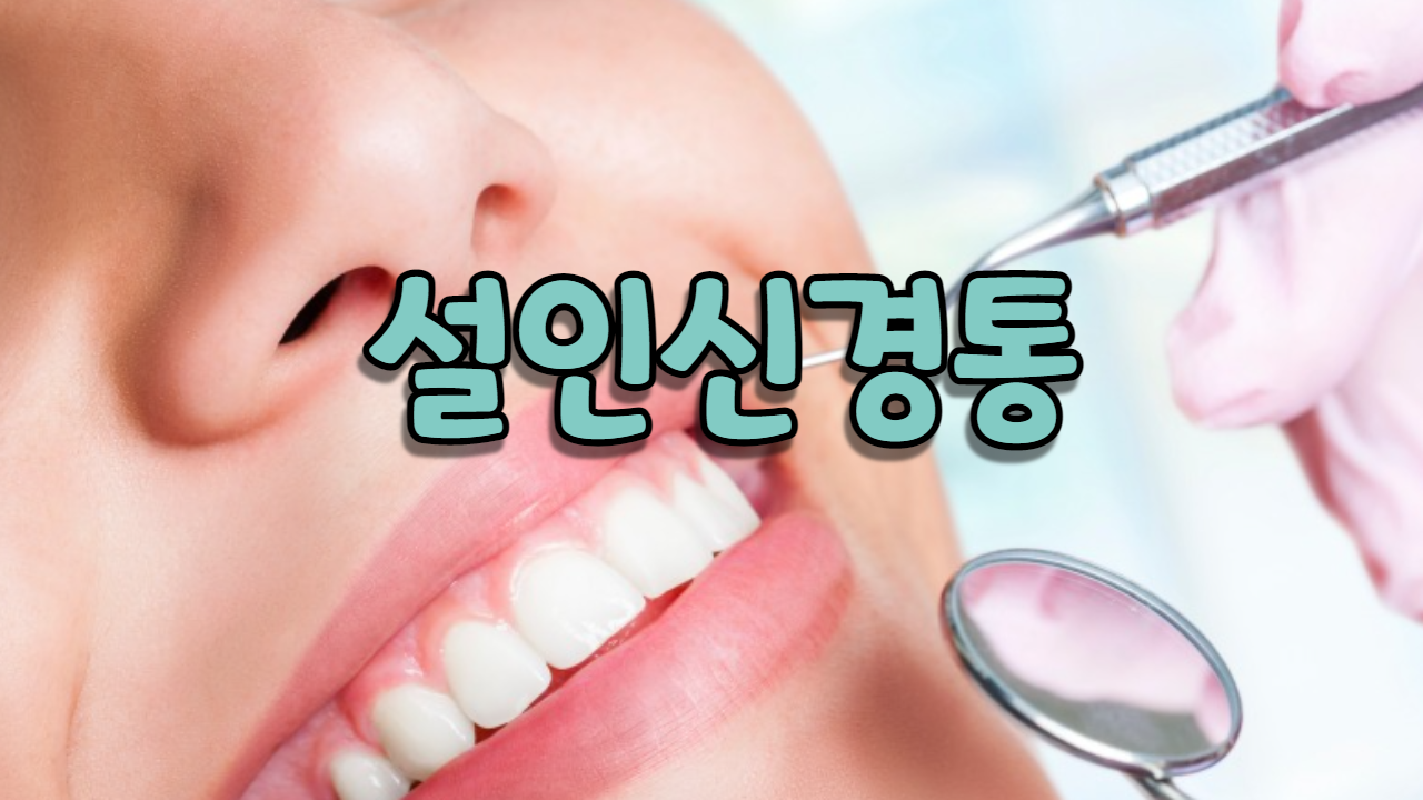  설인 신경통