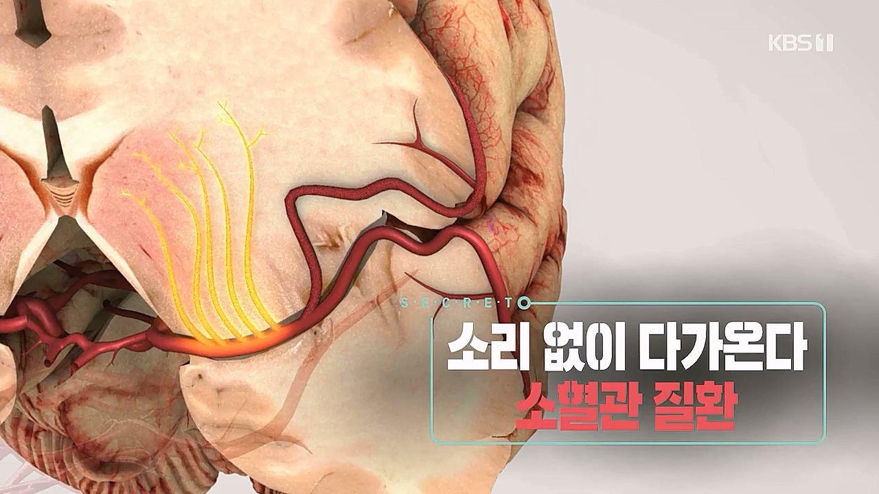 생로병사의비밀.E862.230309p.WANNA.mp4_20230309_192013.318.jpg