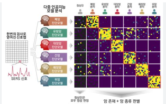 혈소판 분석으로 난소암 조기진단