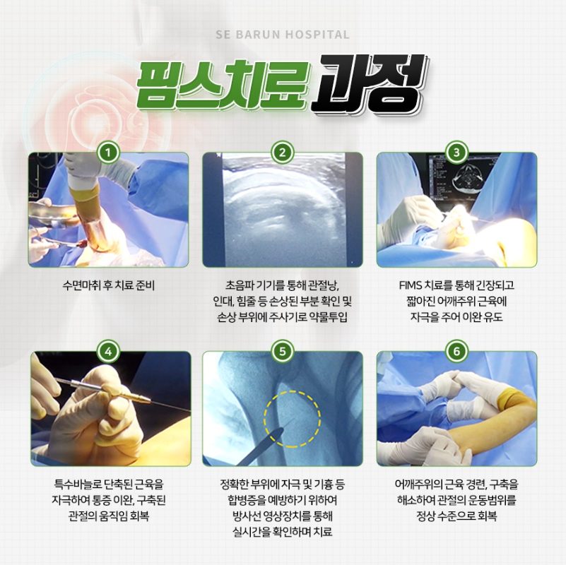  어깨통증 치료 이제는 망설이지 마세요!