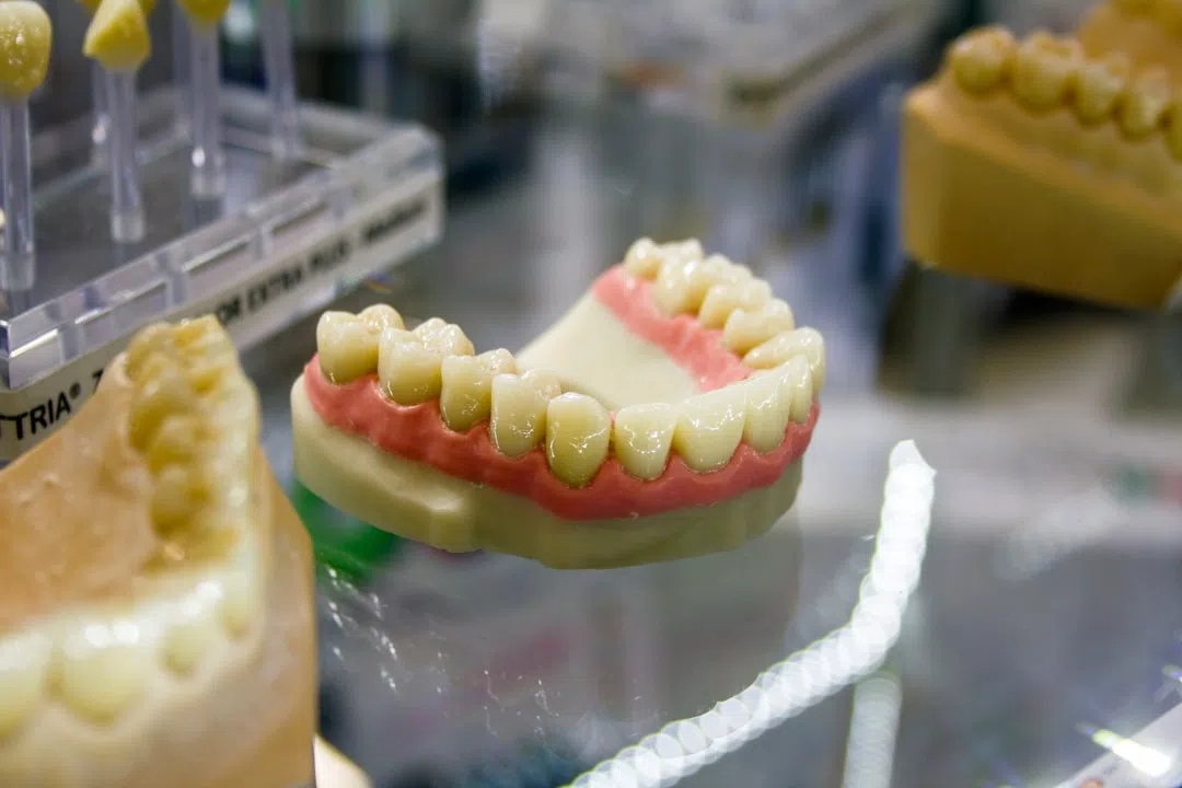 치아신경치료-치아 이미지