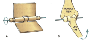 팔꿈치관절-경첩관절
