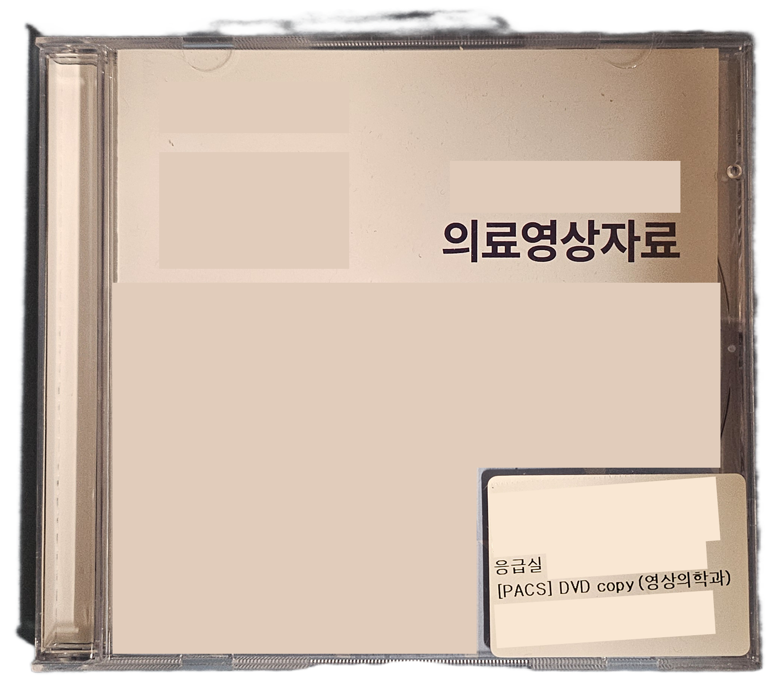 CT가-담긴-CD-모습-이미지