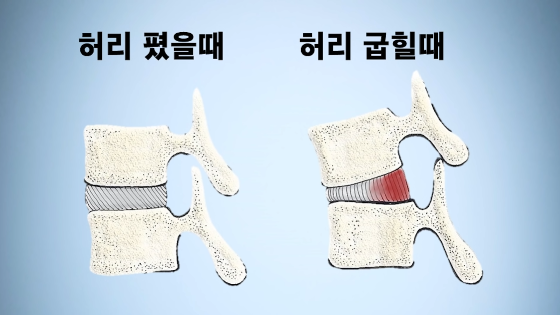  허리디스크를 위한 허리근육 강화법을 알아볼게요