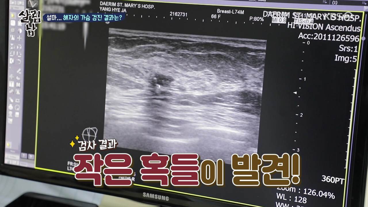  살림남2 팝핀현준 어머니 건강검진에서 소개된 유방 암 자가 검진 가슴 혹 확인 하는 방법