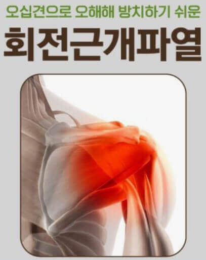  동결견과 비슷하지만, 수술이 필요한 회전근개파열 어깨 통증