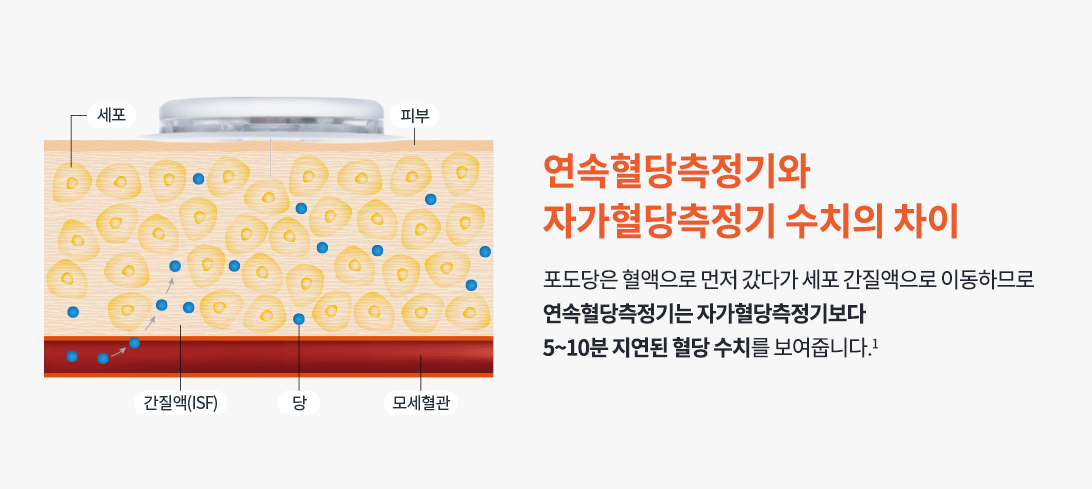 연속혈당 자가혈당 차이