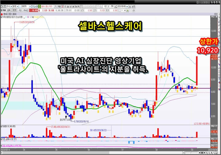 셀바스헬스케어-일-봉-차트