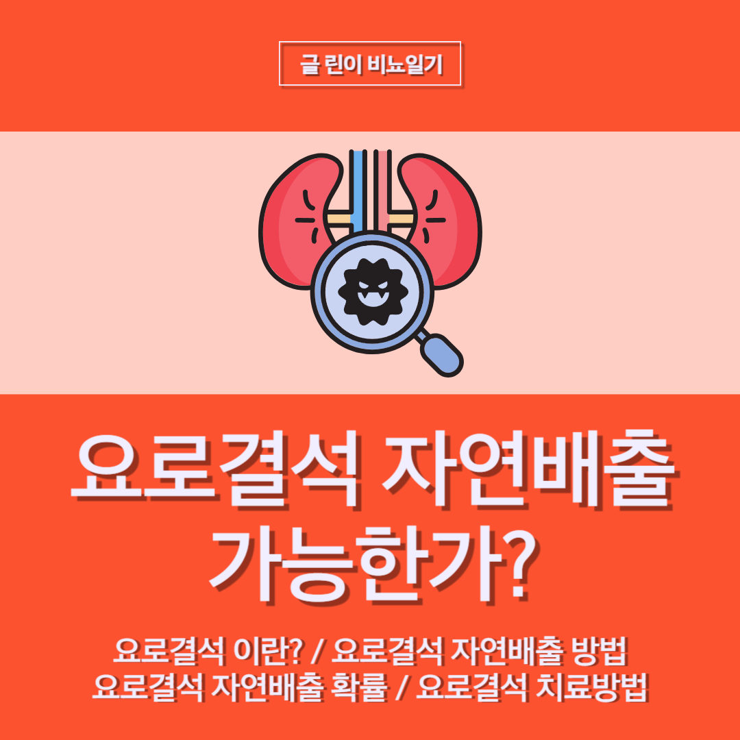  요로결석 자연배출 가능한가?