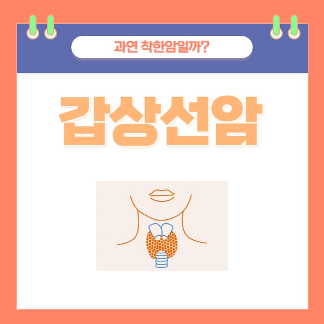  갑상선암, 과연 착한 암일까?