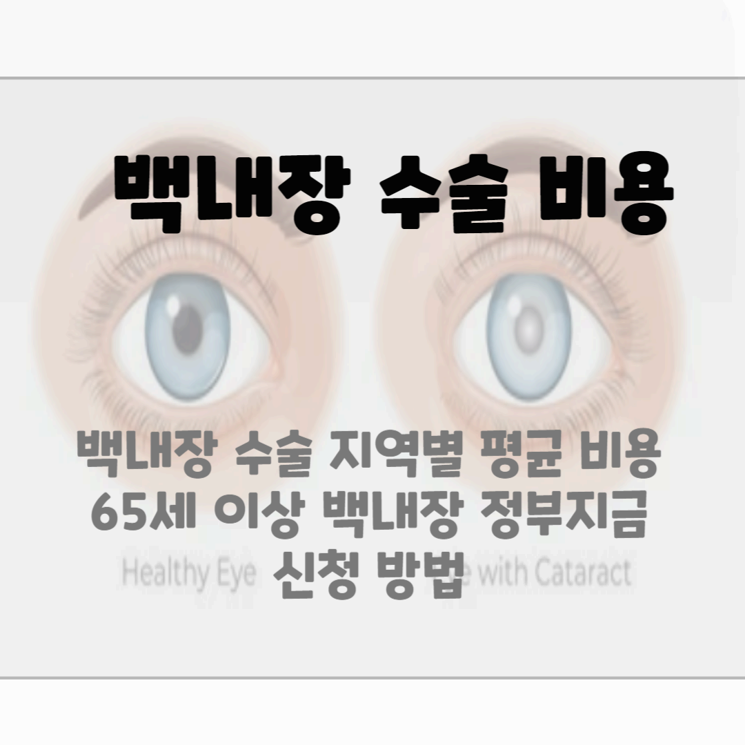 백내장 수술비용&#44; 종류 블로그 썸네일 사진