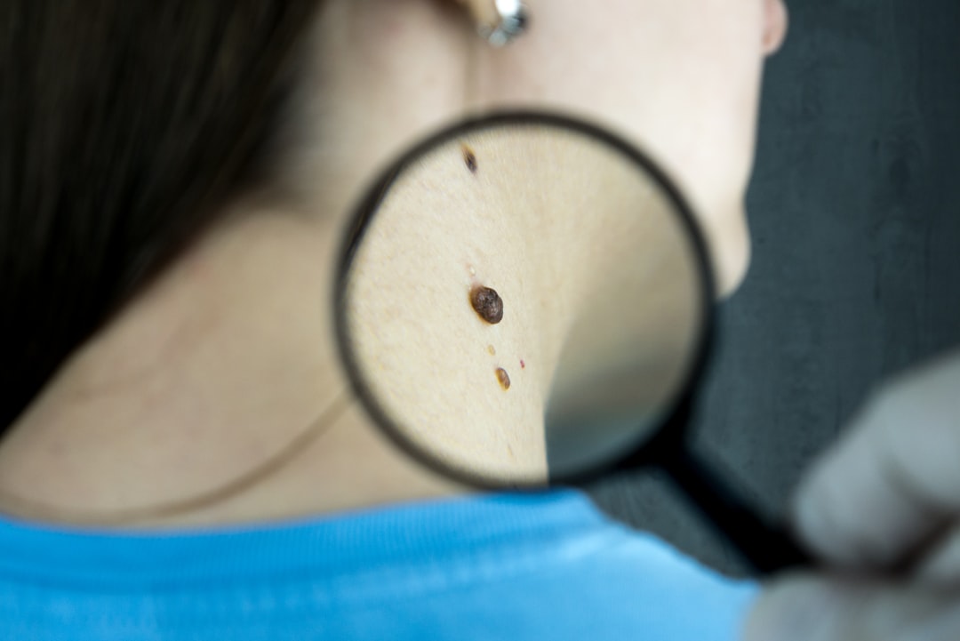 Dermatology
