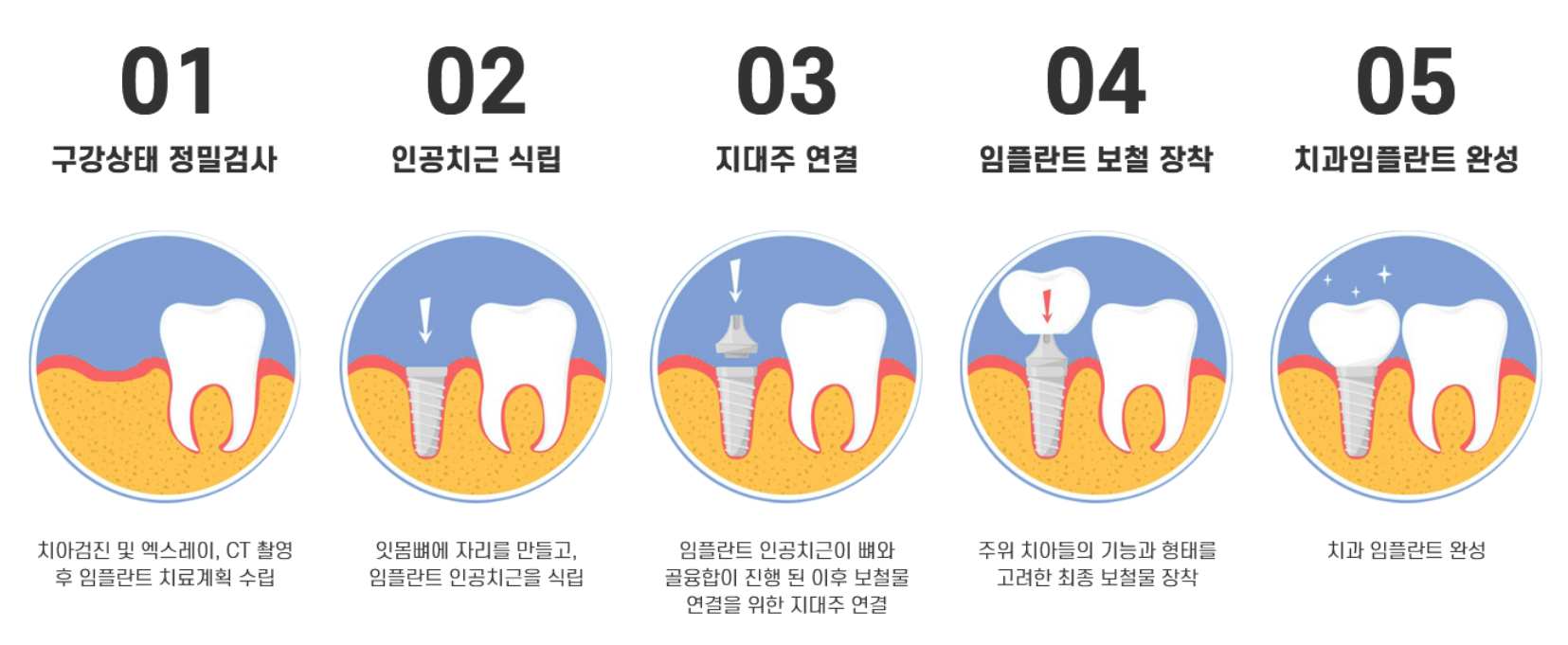 임플란트 비용 무상지원 대상 신청방법