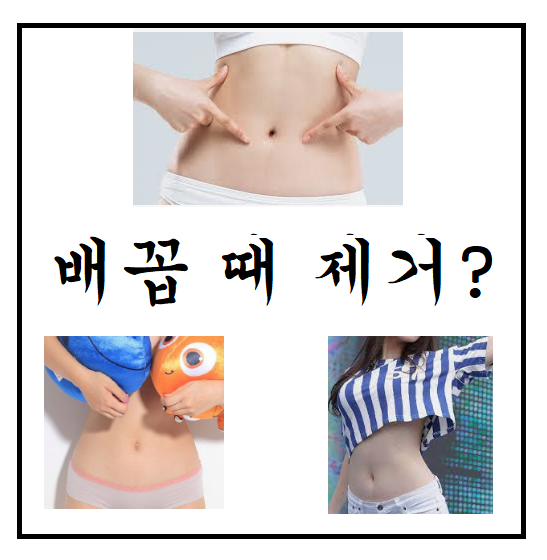  배꼽 때 제거 과연 괜찮을까?