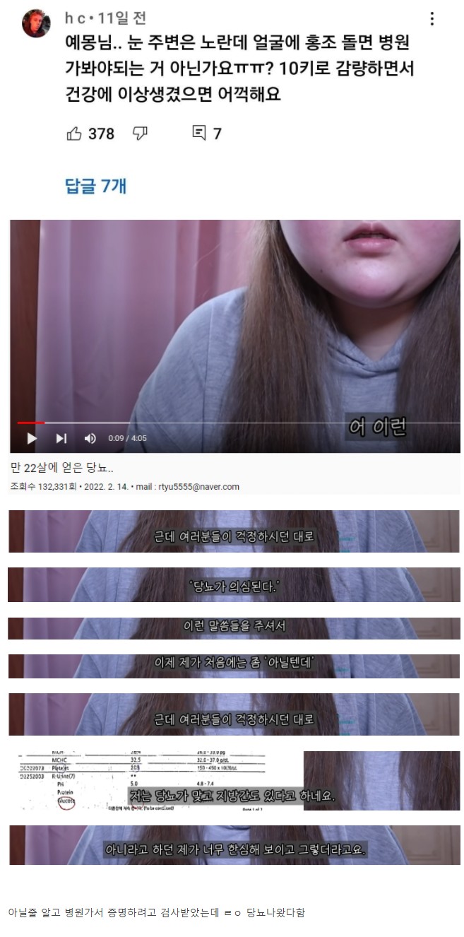 스트리슈