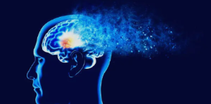 The Risks of Visceral Fat Obesity and Its Impact on Alzheimer's Disease.