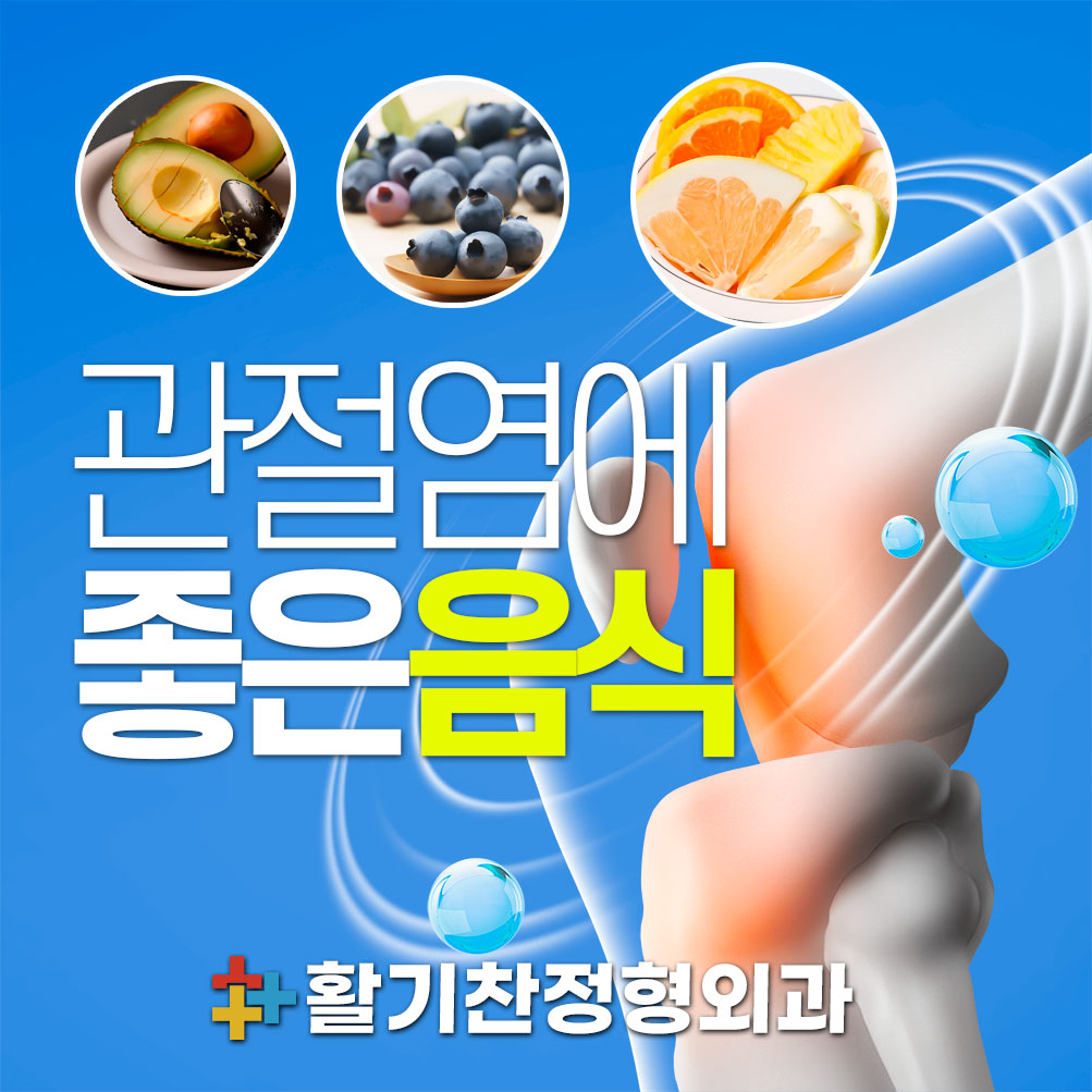  삼송동정형외과, 관절염에 좋은 음식 추천