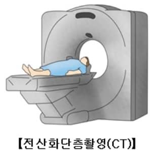 전산화단층촬영