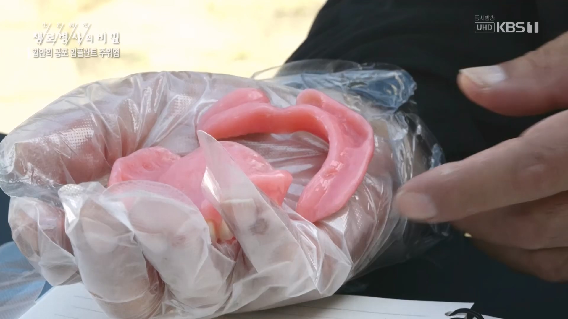 생로병사의 비밀.E890.231213p.H264-F1RST.mp4_20231214_201912.928.jpg