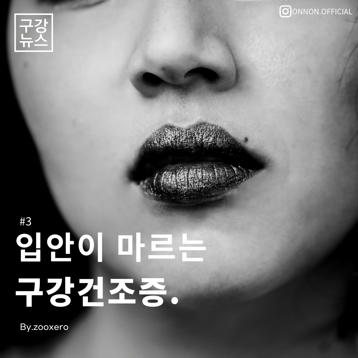  [구강정보] #3 입안이 마르는 구강건조증 해결법은?