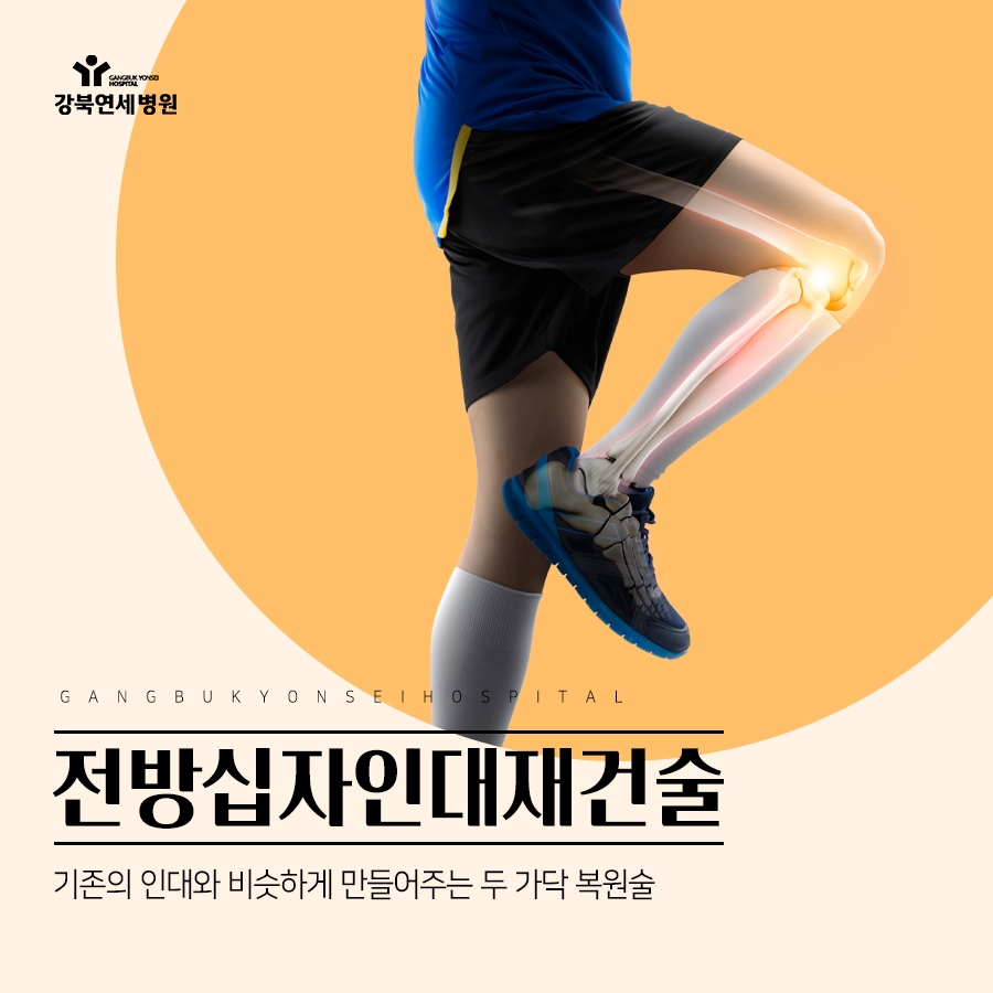 두 가닥 복원술 전방십자인대재건술 안정성을 높인 5