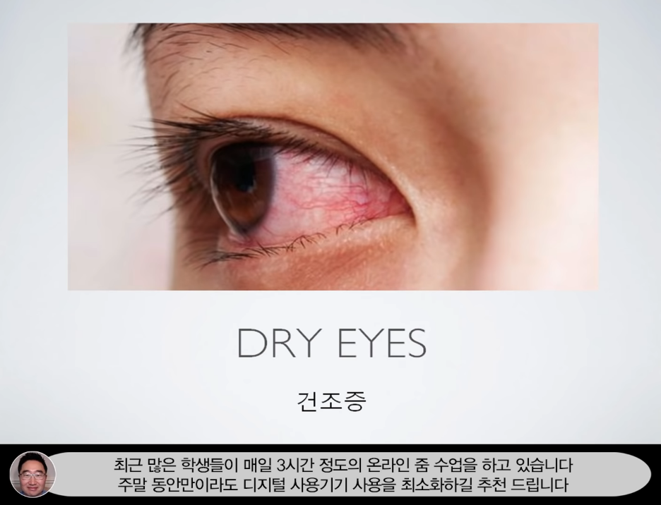  만성충혈이 치료된 의외의 계기