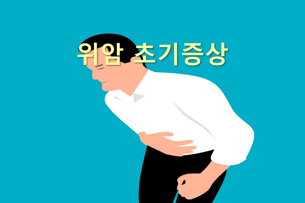 위암 초기증상과 위암 3기 생존율