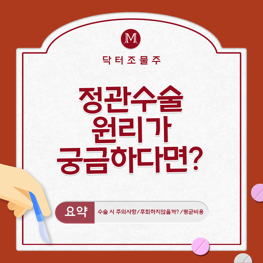  정관수술 원리가 궁금하다면?