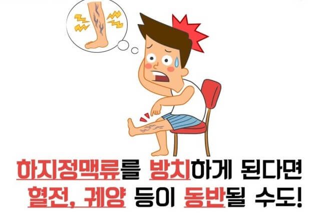 하지정맥류와 혈전