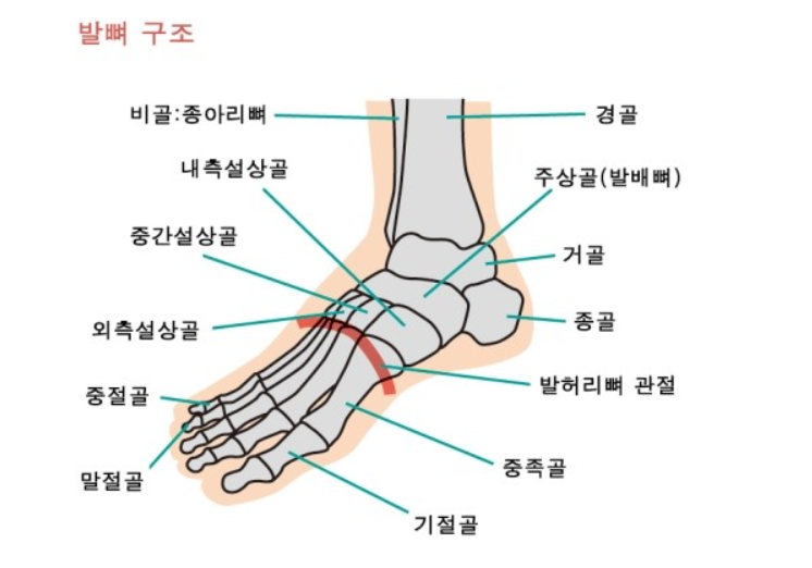 종골 골 관절 인대 파열