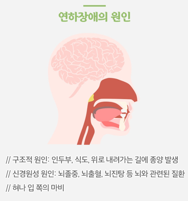 연하장애 원인