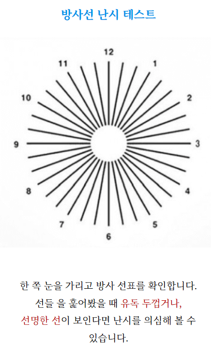 난시 교정수술 비용 치료법