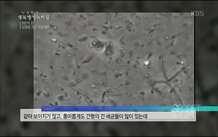 [670회] 생로병사의 비밀 - KBS670회] 생로병사의 비밀.ts_20220505_143158.215.jpg