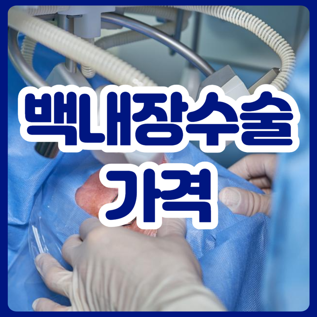 백내장수술가격