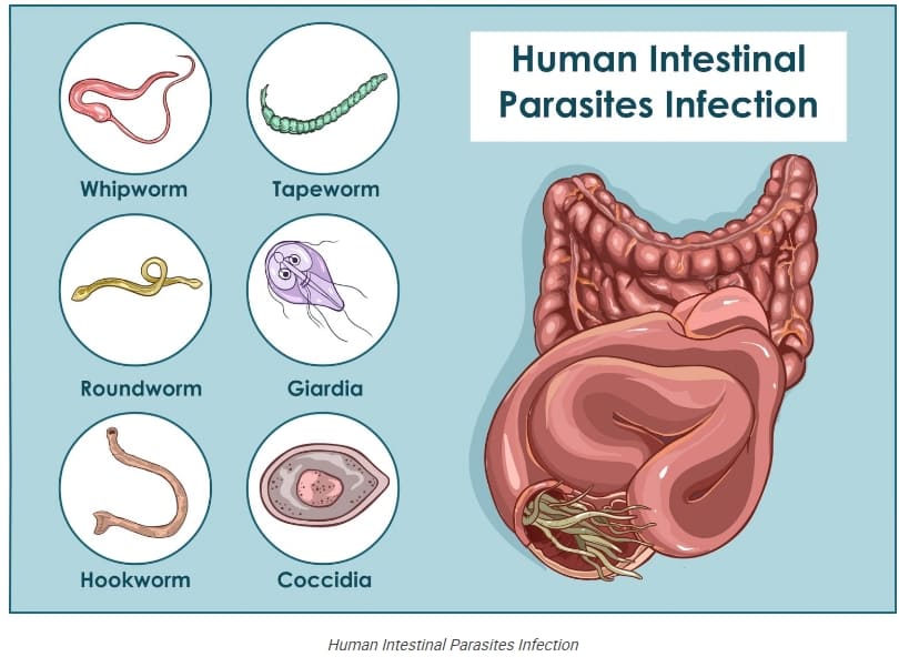 내 뱃 속에 기생충이 있다는 신호들 5 signs you may have intestinal parasites