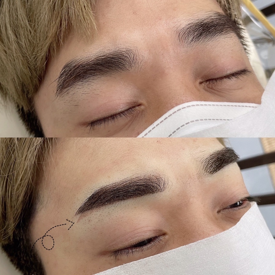  천안눈썹문신:) 탈각후 붉은잔흔 상흔 제거 , 잘하는곳!