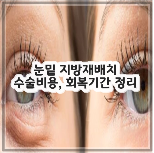 눈밑 지방재배치 수술비용&#44; 회복기간 정리