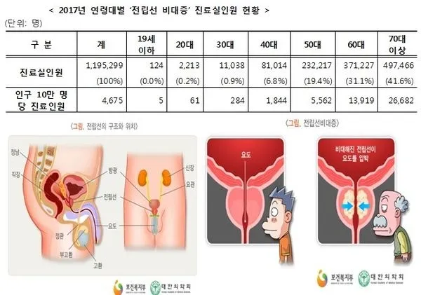 전립선비대증 증상