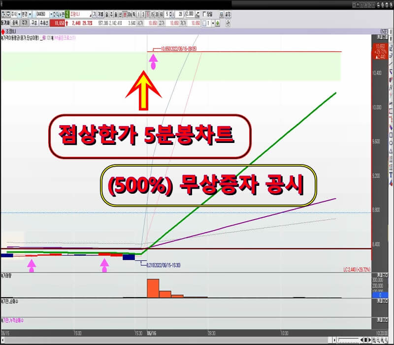 조광ILI-5분-봉-차트