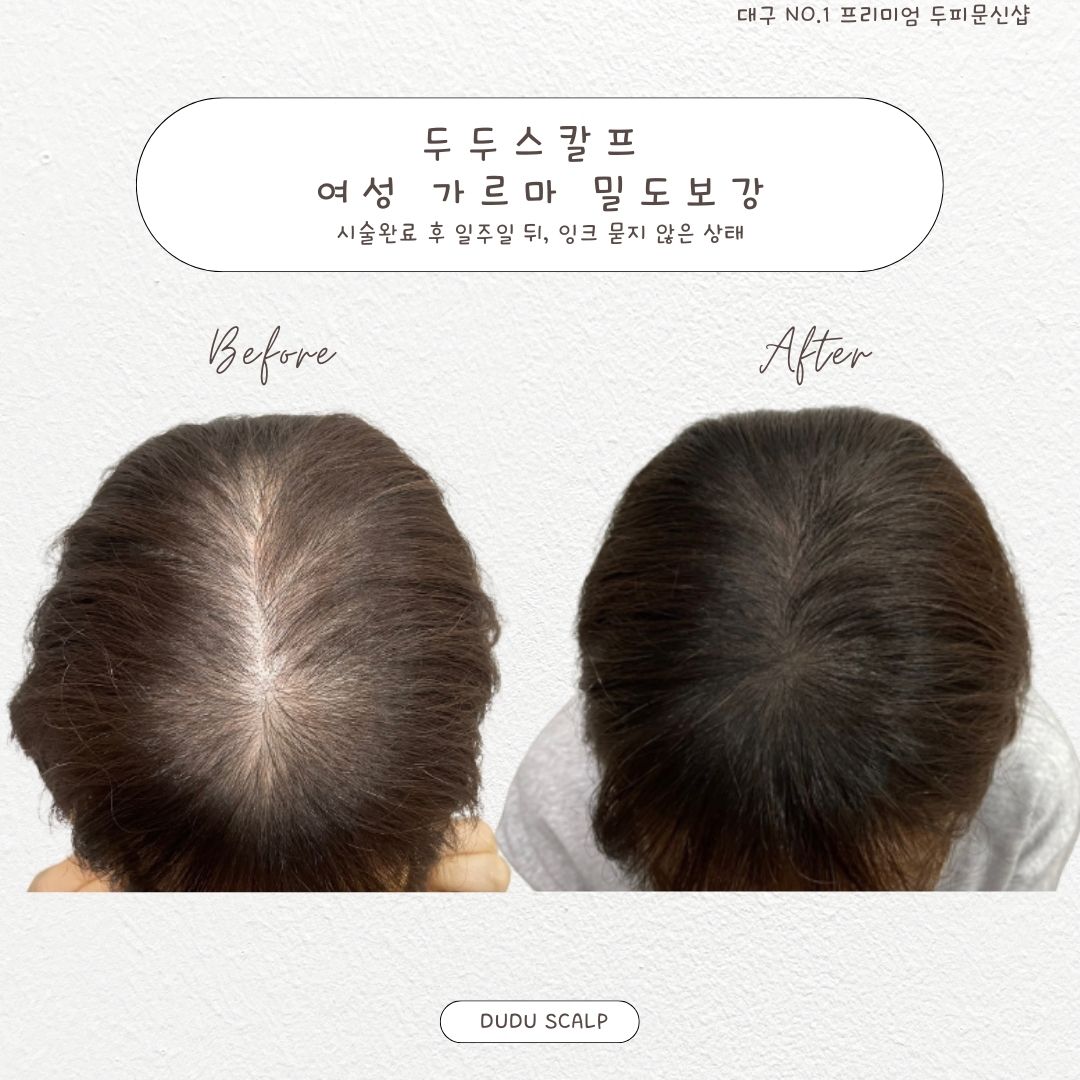 두두솔루션 이미지