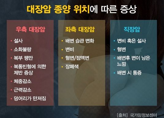 대장암 종양 위치에 따른 증상