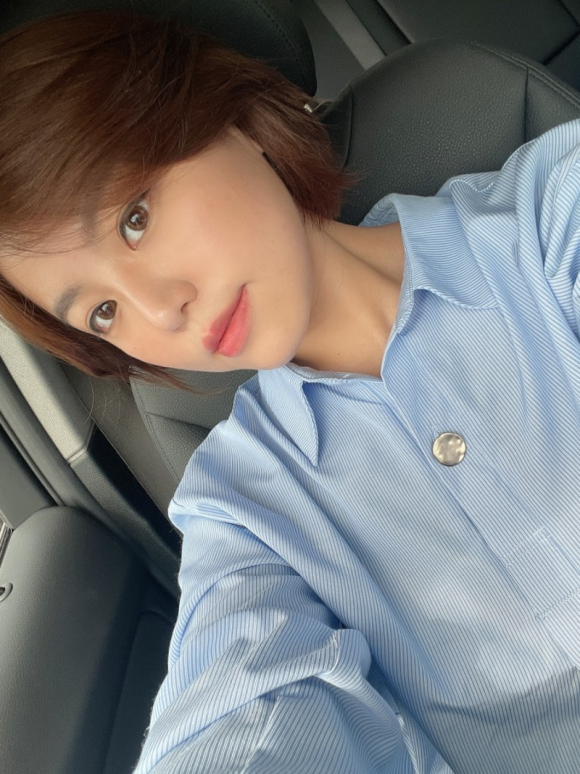 이마필러잘하는곳 후기! 2