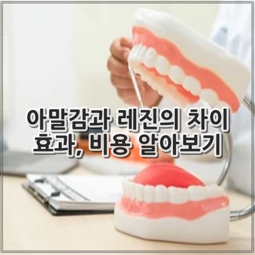 아말감과 레진의 차이 효과, 비용 알아보기