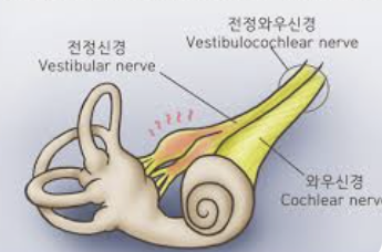 어지러움증의 원인